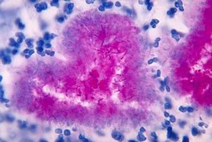 The Decomposers actinomycetes