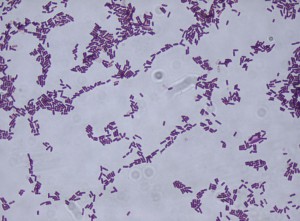 1280px-Bacillus_subtilis_Gram_stain