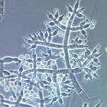 Conidiophores-Tharzianum1