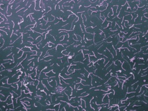 david-phillips-pseudomonas-fluorescens