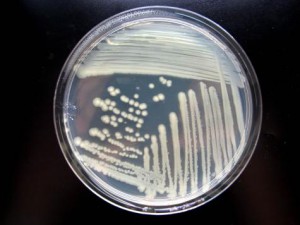 giant microbes pseudomonas